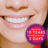 Colgate Optic White ComfortFit LED Teeth Whitening Kit with LED Light and Whitening Pen - Colgate - Nimbus Distributors - wholesale and distributors in United States