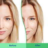 Differin Daily Deep Cleanser with 5% Benzoyl Peroxide, Face Wash for Acne Prone Skin, 4 oz - Differin - Nimbus Distributors - wholesale and distributors in United States